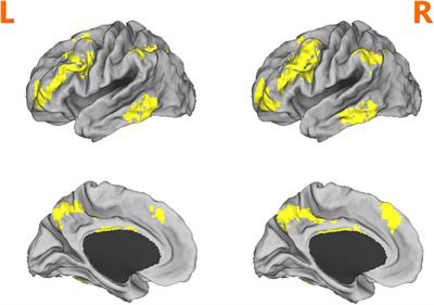 The role of the fronto-parietal network in modulating sustained attention under sleep deprivation: an functional magnetic resonance imaging study